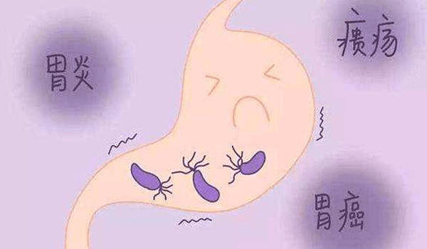 幽门螺杆菌三联、四联疗法与HP食疗法介绍
